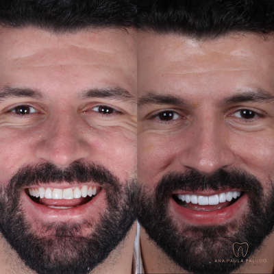 sebastião 2